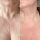Светодиодная маска CurrentBody Skin LED Neck and Dec Perfector для шеи и декольте: Series 1 - изображение 6