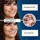 Косметичні накладки на зуби Imako Premium Cosmetic Teeth натуральний білий колір - зображення 2