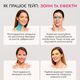 Тейп для обличчя Royal Tapes face care Twins Бежевий- 2 шт 2.5 см - 5 м - зображення 5