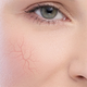 Płyn micelarny Dermedic Redness Calm H2O do demakijażu 500 ml (5901643176389) - obraz 2