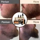 Чоловічий набір 12 в 1 з триммером для догляду за бородою та вусами Coiple Beard, стимуляції росту та створення форми - зображення 6