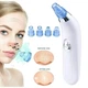 Вакуумний очищувач Derma suction DS Vacuum для професійного чищення шкіри та пор обличчя - легкий компактний зручний прилад у використанні + 4 насадки, Білий - зображення 3