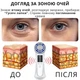 Микротоковый массажер AIMED для лица SkinLift Pro Anti-Aging с функцией RF Lifting, Hot&Cold компрессом EMS и LED светотерапией - изображение 12