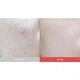 Сыроватка с азелаиновой кислотой 10% и мадекасосидом Dr.Ceuracle Azelaic 10 & Madeca Ampoule - изображение 3