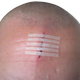 Пластирні смужки Steri-Strip™ 3M 6 мм х 100 мм (R1546) - зображення 8
