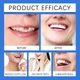 Набор для временного ремонта зубов Oralhoe - изображение 5