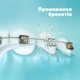 Насадки для ирригатора Panasonic WEW0987W503 (2 шт) - изображение 6