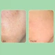 Пилинг-сыворотка со спикулами для лица Medi-Peel Phyto Cica Nol B5 3000 Shot - изображение 2