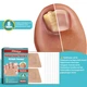 Наклейки-пластыри для ухода за вросшими ногтями Nail Patches, 16 шт в упаковке U9360 - изображение 6