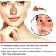 Сонцезахисний пластир патч для носа Eelhoe UV Protection Nose Patch, 24 шт - изображение 2