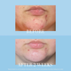 Гель для обличчя Kate Somerville EradiKate Acne Mark Fading 30 мл (810023370543) - зображення 5