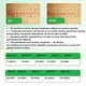 Два комплекта пластырей Elaimei в рулоне 4,6 см х 4 м и полосками 15x4 см - изображение 6
