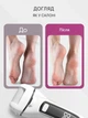 Электрическая пемза Callus Remover V-601 для ног и пят Аккумуляторная роликовая пилка с набором по уходу за ножками Белый 519668619 - изображение 9