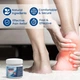 Знеболюючий крем для п'ят Sumifun Heel Pain Relief Cream, 20 г - изображение 2