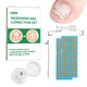 Коректор врослого нігтя Ingrowing Nail Correction Set - изображение 1