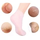Силіконові гелеві зволожуючі шкарпетки Soft Gel Socks Rose - зображення 3