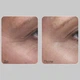 Крем для век с эффектом лифтинга Medi-Peel Peptide 9 Volume Lif-Tox Eye Cream - изображение 2