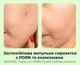 Ампульная сыворотка MEDIPEEL Young Cica PDRN Trouble Soothing Ampoule с центеллой и PDRN 50 мл (8809941824308) - изображение 3