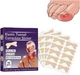 Набор для коррекции врастающих ногтей Elastic Toenail Correction Sticker 50 шт Бежевый (2104618421) - изображение 4