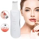 Ультразвуковой скраббер портативный для чистки лица Face Cleaner 8816 / Очиститель пор / Скрабер лифтинг - изображение 6