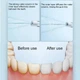 Іригатор Mijia Teeth Flosser MEO703 F300 (White) - изображение 11