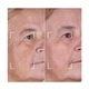 Набор CurrentBody Skin LED Light Therapy Face Neck Kit: Series 2 для лица, шеи и зоны декольте - изображение 7
