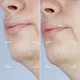 Лазерный эпилятор CurrentBody Skin Laser Hair Removal Device - изображение 6