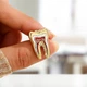 Брошь-значок BROCHE бижутерия Медицина Зуб анатомический золотистая BRGV115032 - изображение 5