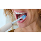 Насадки для зубної щітки Philips Sonicare Premium Plaque Defence HX9044/87 4 шт - зображення 4