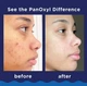 Panoxyl Acne Foaming wash Acne 10% Пінка для вмивання від акне 28 г - зображення 4