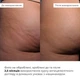 Курс антицеллюлитного ухода в домашних условиях с ниацинамидом Niacinamide Anti-Cellulite Home Care Hillary 2314942172564 - изображение 4