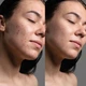 Вакуумний очищувач шкіри і пор MEDICA+ SKINCLEANER 9.0 BL - зображення 6