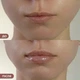 Бальзам-блеск для губ Hillary Sparkling Kiss, 10 мл HI-05-965 - изображение 2