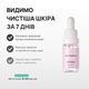 Лосьйон для проблемної шкіри від комедонів та чорних цяток Skinexi Soft Daily Lotion 15 мл - зображення 2