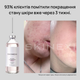 Лосьон для проблемной кожи от прыщей и акне Skinexi Dry Lotion Formula+ 250 мл - изображение 5