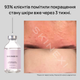 Лосьйон для проблемної шкіри від комедонів та чорних цяток Skinexi Soft Daily Lotion 100 мл - зображення 8