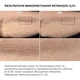 Сыворотка для активного восстановления кожи Hillary ReNuAge Retinol Active Renewal Serum, 30 мл HI-08-711 - изображение 10