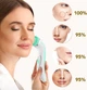 Szczoteczka do twarzy Lumineo Brush Pro 4 końcówki + żel do skóry wrażliwej turkusowa (5904726872772) - obraz 8