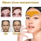 Пластирі від зморшок на лобі EELHOE Forehead Wrinkle Patch Розгладження шкіри та ліфтинг - изображение 4