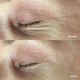 Патчи для зоны вокруг глаз HydroPeptide PolyPeptide Collagel + Mask for eyes RPCE - изображение 6