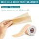 Силиконовый пластырь от рубцов и шрамов Silicone Scar Sheets - изображение 9