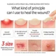 Пластыри-патчи для лечения воспалений Elizavecca Blemish Spot Patch 44 шт - изображение 4