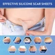 Силиконовый пластырь от шрамов и рубцов Aroamas Silicone Scar Tape (4х150 см) - изображение 9