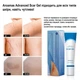 Гель від рубців і шрамів Aroamas Advanced Scar Gel 30 гр - зображення 6