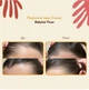 Разогревающий лосьйон для роста волос HairTry Babyhair Fever 200 мл - изображение 2
