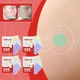 Точечные пластыри-патчи Звездочки от прыщей одноразового применения 240 шт. Разноцветный - изображение 5