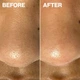 Косметичний засіб Dermaflash Dermapore+ Blush, 207 мл - изображение 3