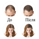 Камуфляж для волос Toppik Hair Building Fibers Medium Brown пудра 27,5 г - изображение 2