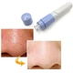 Вакуумный очиститель пор для лица Pore Cleaner для нормализации кожи и выведения токсинов, портативный на батарейках - изображение 3