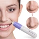Вакуумный очиститель пор для лица Pore Cleaner для нормализации кожи и выведения токсинов, портативный на батарейках - изображение 5